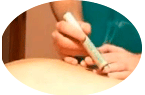 moxa moxibustion soin de digito-puncture en MTC 